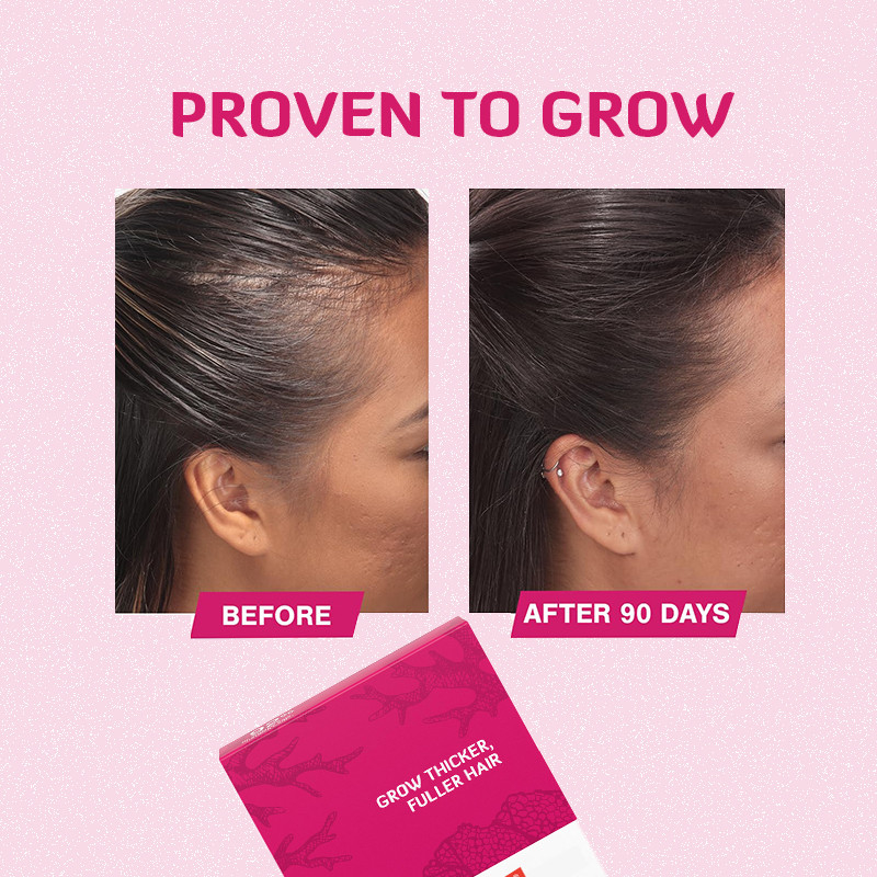 เม็ดเติบโตผม 120mcg Biotin Hair Growth Product สําหรับการเติบโตผม